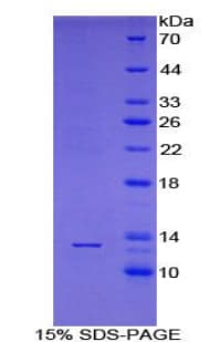 Human PABPC1L Protein (Recombinant His)