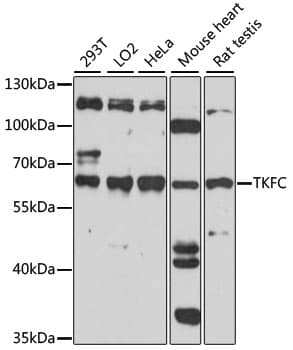 Polyclonal Rabbit anti-Human TKFC / DAK Antibody (WB)