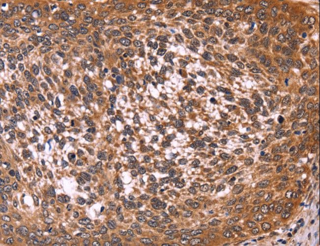 CCDC106 Antibody