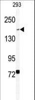 BCOR Antibody (aa1107-1137)