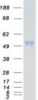 Human CSNK1E / CK1 Epsilon Protein (Recombinant Myc-DDK (Flag))