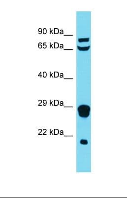 MRPL18 Antibody (N-Terminus)