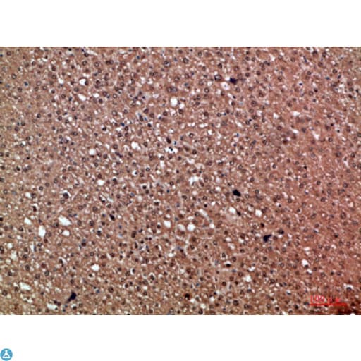 HDGF Antibody