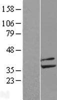 PP2CB / PPP2CB Protein (Over-Expression Lysate Myc-DDK (Flag))