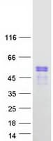 Human PBX2 Protein (Recombinant Myc-DDK (Flag))