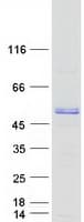 Human CALU / Calumenin Protein (Recombinant Myc-DDK (Flag))