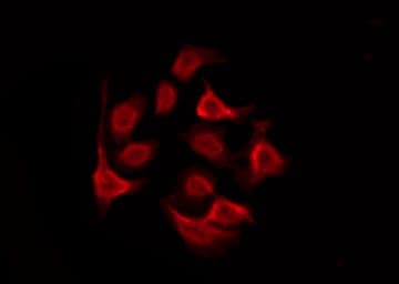 Polyclonal Rabbit anti-Human GPRC5D Antibody (IF, WB)
