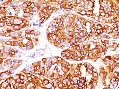 PathPlus™ MLANA / Melan-A Antibody (clone MLANA/1409R)