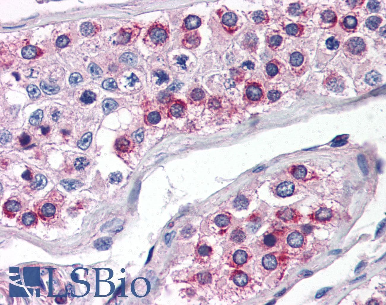 IHC-plus™ ATG16L1 / ATG16L Antibody