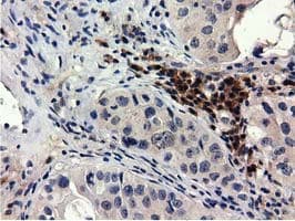 QPRT Antibody (clone OTI1C10, Carrier-free)