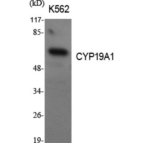 Polyclonal Rabbit anti-Human CYP19 / Aromatase Antibody (190-270 aa, Internal, IHC, IF, WB)