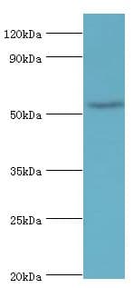 Polyclonal Rabbit anti-Human BANP Antibody (aa1-260, IHC, WB)