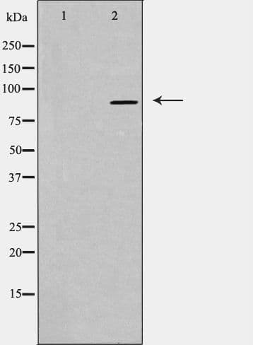 CDH16 / Cadherin 16 Antibody
