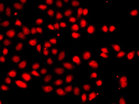 HIF2A / EPAS1 Antibody