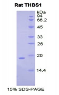 Rat THBS1 / Thrombospondin-1 Protein (Recombinant His, C-terminus)