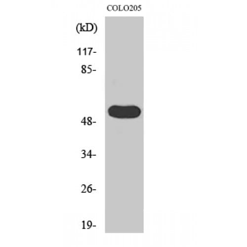 Polyclonal Rabbit anti-Human LIPI Antibody (260-340 aa, Internal, IHC, WB)