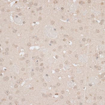 Polyclonal Rabbit anti-Human GPKOW Antibody (IHC, WB)