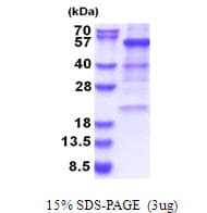 Human GLUD1/Glutamate Dehydrogenase Protein (Recombinant His)