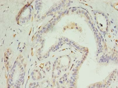 DIP2A Antibody