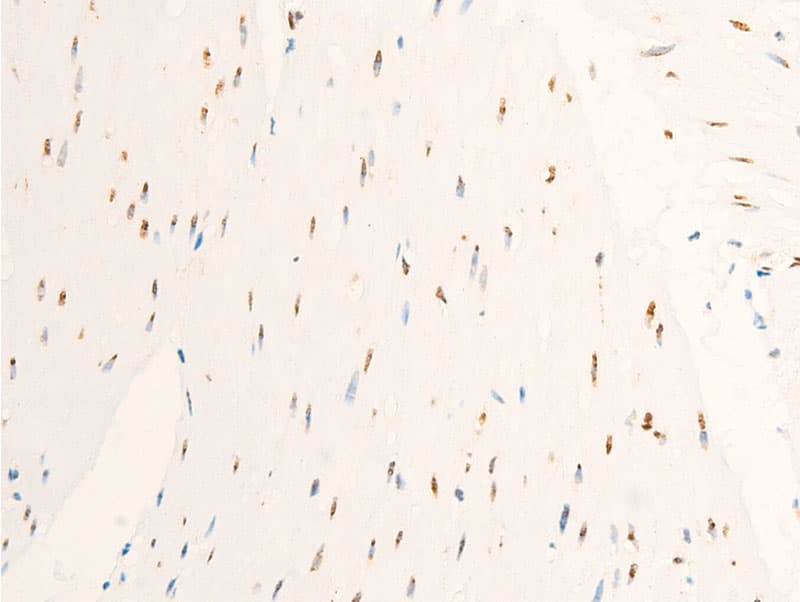 Polyclonal Rabbit anti-Human MYC / c-Myc Antibody (phospho-Ser62, IHC, IF, WB)