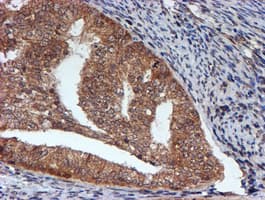 HARS2 Antibody (clone OTI5H2)