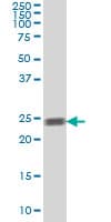 Monoclonal Mouse anti-Human RAB5A / RAB5 Antibody (clone 5D1, WB)