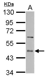 IHC-plus™ ENTPD5 / CD39L4 Antibody