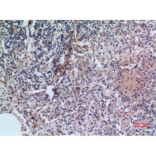 Polyclonal Rabbit anti-Human CD38 Antibody (211-260 aa, Internal, IHC, WB)