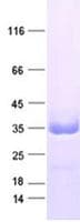 Human ZFAND5 Protein (Recombinant DDK,C-terminus)