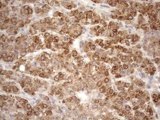 Monoclonal Mouse anti-Human NT5E / eNT / CD73 Antibody (clone OTI1G2, aa119-232, IHC, WB)