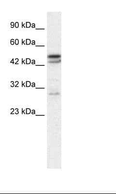 Polyclonal Rabbit anti-Human CHRNA3 Antibody (aa26-75, IHC, WB)