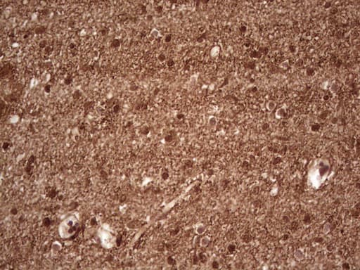 Monoclonal Mouse anti-Human NEFM / NF-M Antibody (clone OTI2G3, aa413-773, IHC, WB)