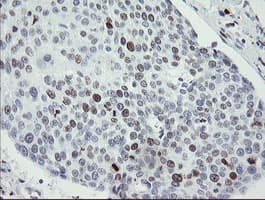MAFB Antibody (aa32-320, clone OTI1E9)