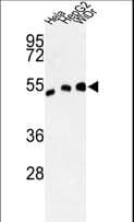 Polyclonal Rabbit anti-Human ALDH3A2 Antibody (IHC, WB)