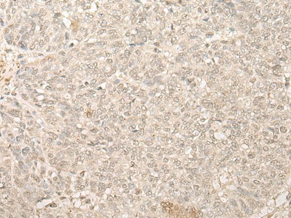 Polyclonal Rabbit anti-Human FYTTD1 Antibody (IHC)