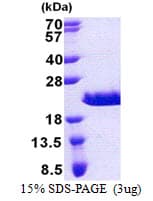 Human RPAIN Protein (Recombinant His)