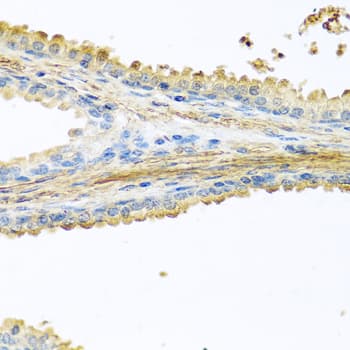 IHC-plus™ Polyclonal Rabbit anti-Human PIP / GCDFP-15 Antibody (IHC, IF)