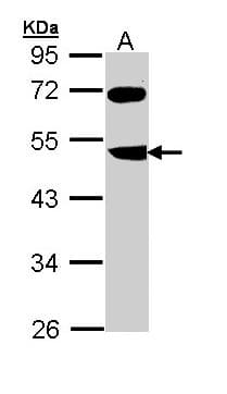 Polyclonal Rabbit anti-Human FBXL3 Antibody (aa14-309, WB)