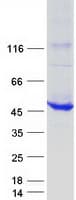 Human BBOX1 / BBOX Protein (Recombinant Myc-DDK (Flag))