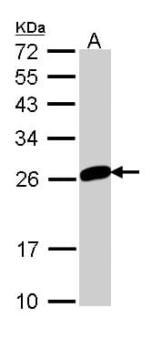 IHC-plus™ Polyclonal Rabbit anti-Human MAD2L1 / MAD2 Antibody (IHC, WB)