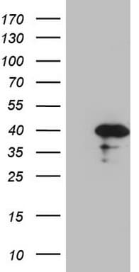 CDCA8 / Borealin Antibody (clone OTI4G3)
