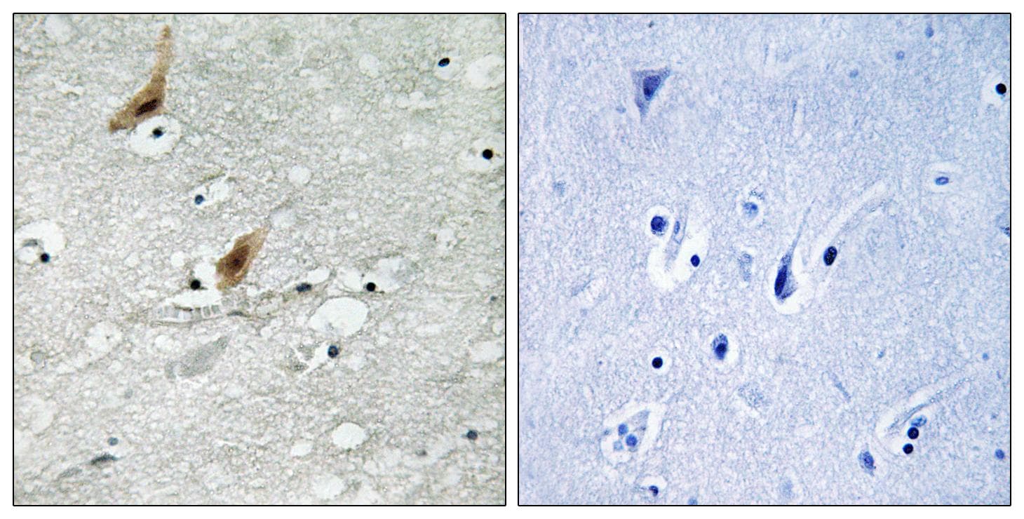 RPS6KA4 / MSK2 / RSK-B Antibody (phospho-Thr568)