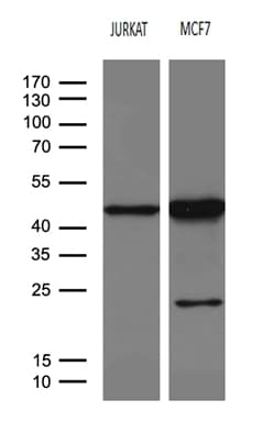 Monoclonal Mouse anti-Human SERPINB8 Antibody (clone OTI9B2, Carrier-free, aa169-374, WB)