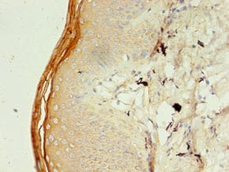 SPRING / TRIM9 Antibody (aa1-550)