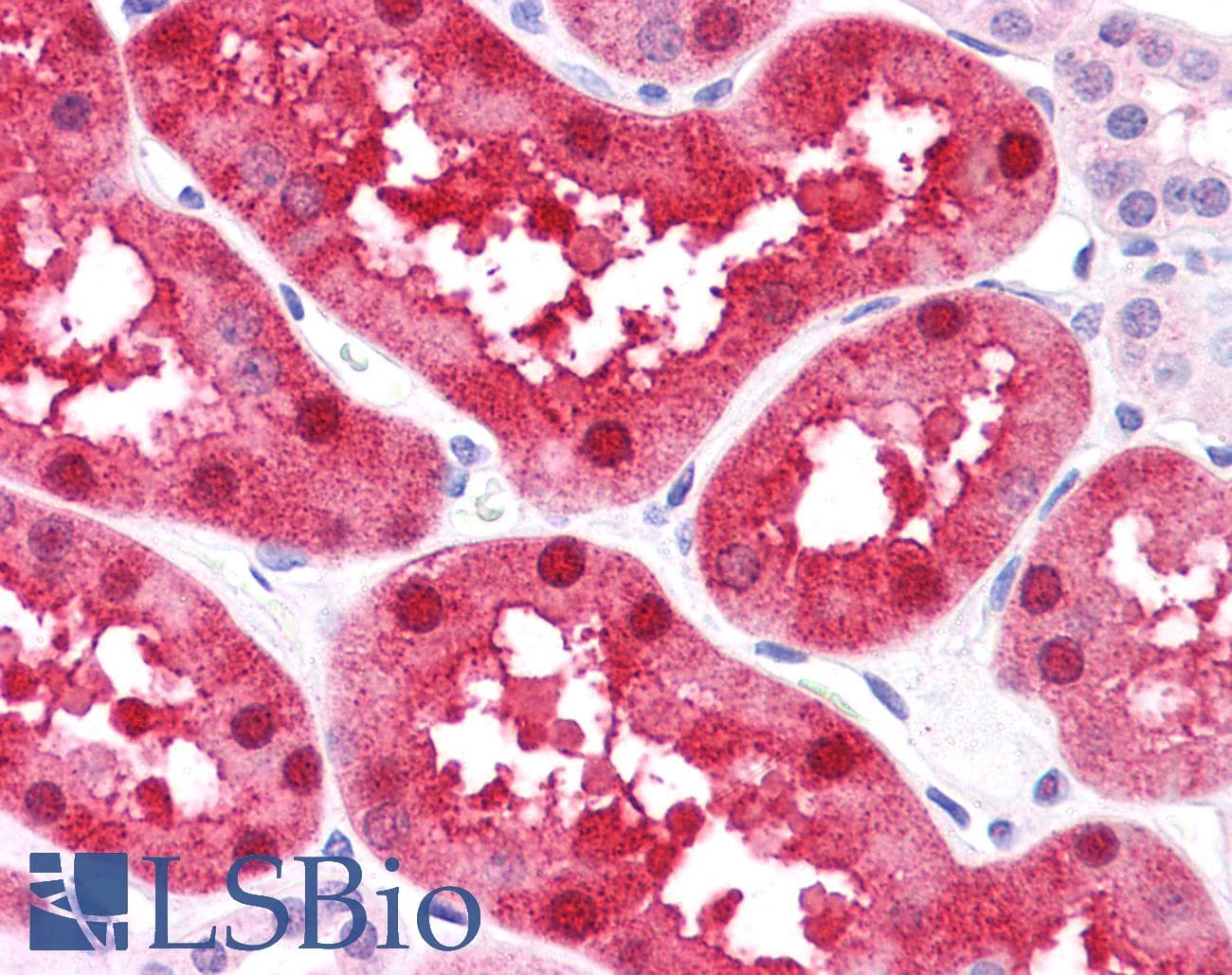 FABP1 / L-FABP Antibody (N-Terminus)
