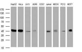 TIA-1 Antibody (clone OTI1C3)