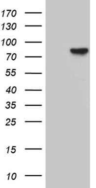 Monoclonal Mouse anti-Human RPS6KA2 / RSK3 Antibody (clone OTI2G5, aa1-51, WB)