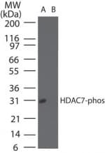 HDAC7 Antibody (phospho-Ser155)