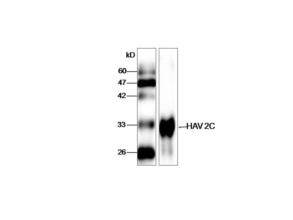 HAV Polyprotein Antibody (aa1141-1370, clone BU-33)