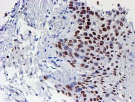WWTR1 / TAZ Antibody (clone OTI1H9)